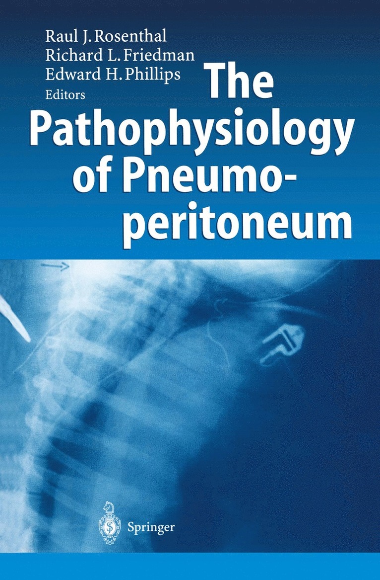 Raul J. Rosenthal, Richard L. Friedman, Edward H. Phillips - Pathophysiology of Pneumoperitoneum, Häftad