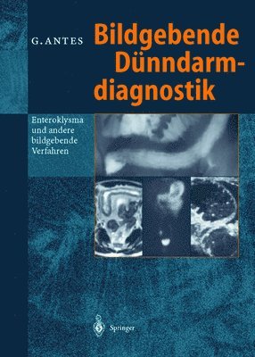 bokomslag Bildgebende Dnndarmdiagnostik