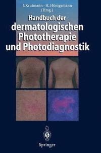 bokomslag Handbuch der dermatologischen Phototherapie und Photodiagnostik
