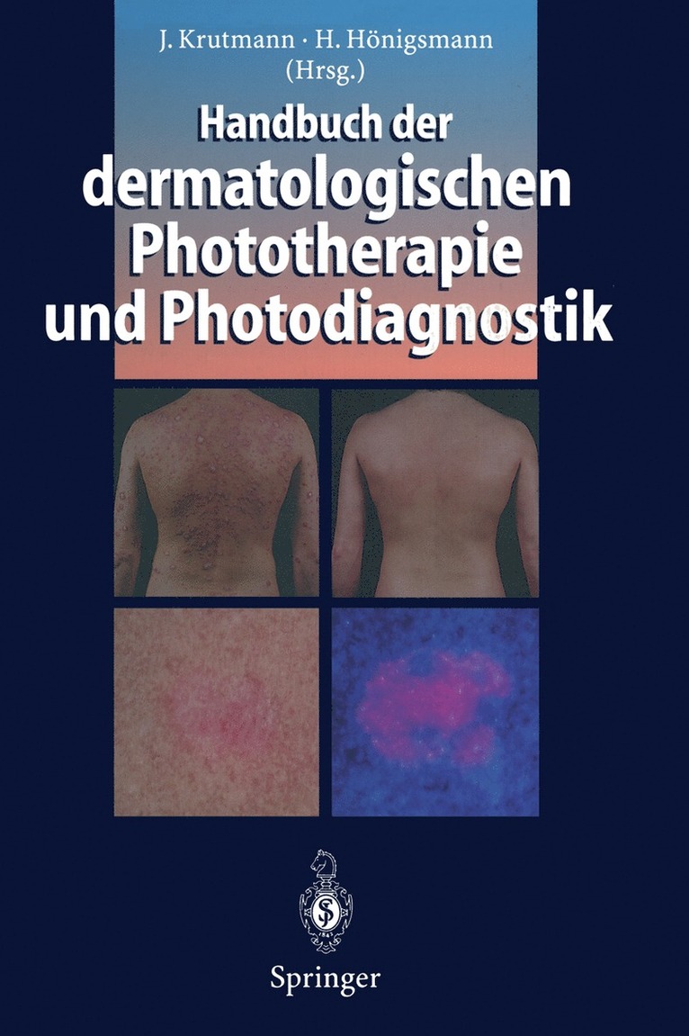 Jean Krutmann, Herbert Hönigsmann - Handbuch der dermatologischen Phototherapie und Photodiagnostik, Häftad