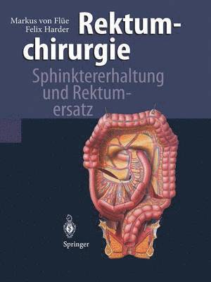 Markus von Flüe, Felix Harder, Markus Von Flüe - Rektumchirurgie, Häftad