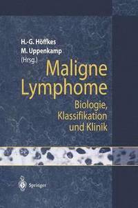 bokomslag Maligne Lymphome