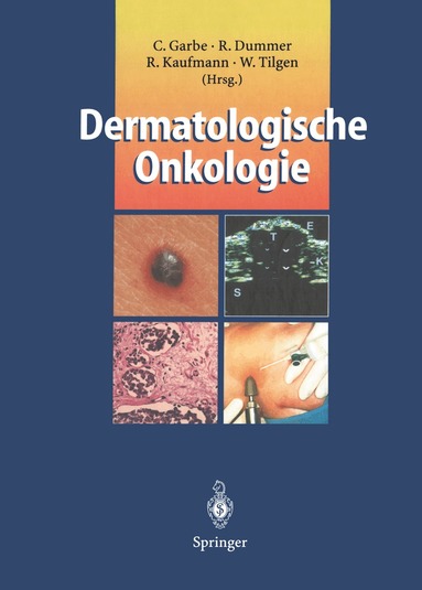 Claus Garbe, Reinhard Dummer, Roland Kaufmann, Wolfgang Tilgen - Dermatologische Onkologie, Häftad