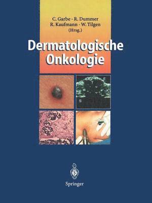 bokomslag Dermatologische Onkologie