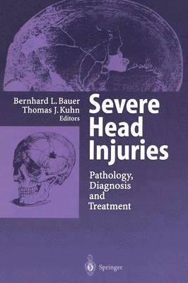 Bernhard L. Bauer, Thomas J. Kuhn - Severe Head Injuries, Häftad