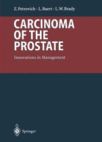 bokomslag Carcinoma of the Prostate