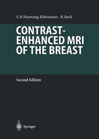 bokomslag Contrast-Enhanced MRI of the Breast