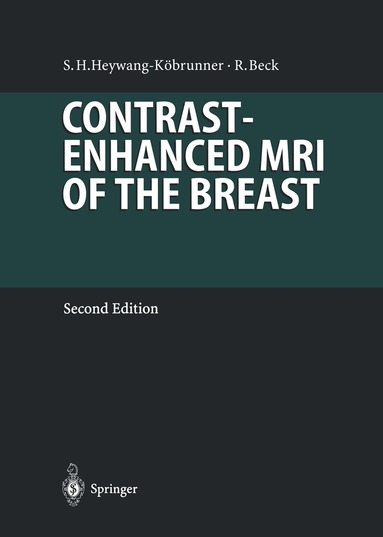 Sylvia Heywang-Köbrunner, Rainer Beck - Contrast-Enhanced MRI of the Breast, Häftad