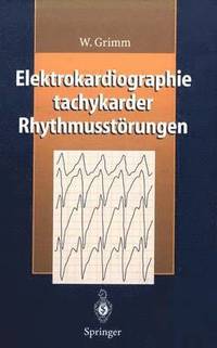 bokomslag Elektrokardiographie tachykarder Rhythmusstrungen