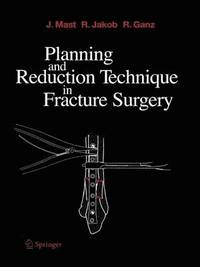 bokomslag Planning and Reduction Technique in Fracture Surgery