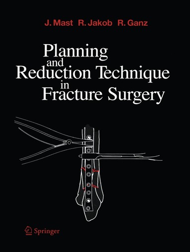 Jeffrey Mast, Roland Jakob, Reinhold Ganz - Planning and Reduction Technique in Fracture Surgery, Häftad