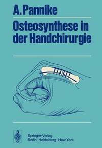 bokomslag Osteosynthese in der Handchirurgie