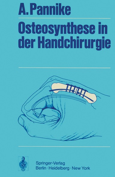 A. Pannike - Osteosynthese in der Handchirurgie, Häftad