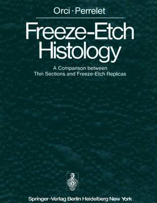 Freeze-Etch Histology 1