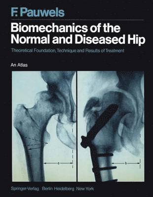 Biomechanics of the Normal and Diseased Hip 1