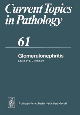 Glomerulonephritis
