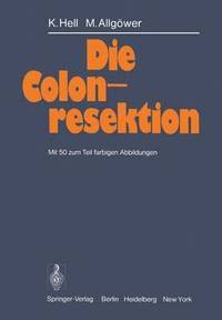 bokomslag Die Colonresektion