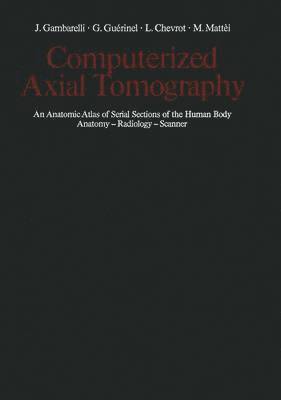 bokomslag Computerized Axial Tomography