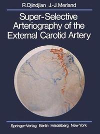 bokomslag Super-Selective Arteriography of the External Carotid Artery