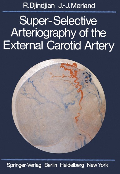 bokomslag Super-Selective Arteriography of the External Carotid Artery