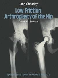 bokomslag Low Friction Arthroplasty of the Hip