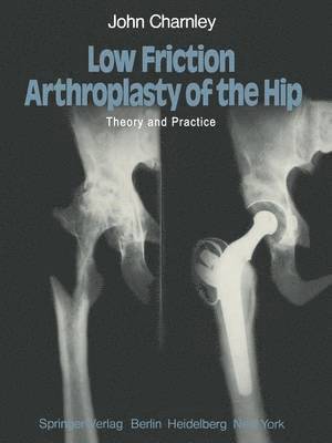 J. Charnley - Low Friction Arthroplasty of the Hip, Häftad