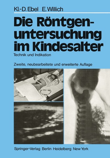 Klaus-D. Ebel, Eberhard Willich - Die Röntgenuntersuchung im Kindesalter, Häftad