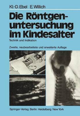 Klaus-D. Ebel, Eberhard Willich - Die Röntgenuntersuchung im Kindesalter, Häftad