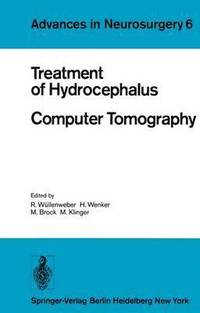 bokomslag Treatment of Hydrocephalus Computer Tomography