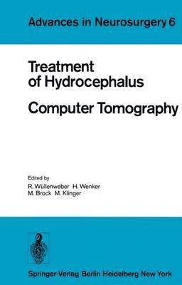 Treatment of Hydrocephalus Computer Tomography 1