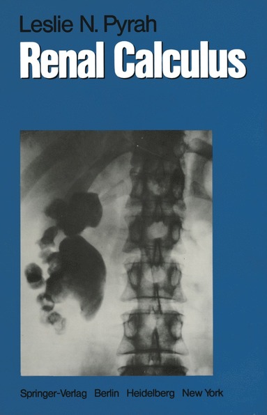 bokomslag Renal Calculus