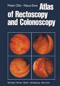 bokomslag Atlas of Rectoscopy and Coloscopy