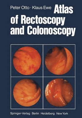 bokomslag Atlas of Rectoscopy and Coloscopy
