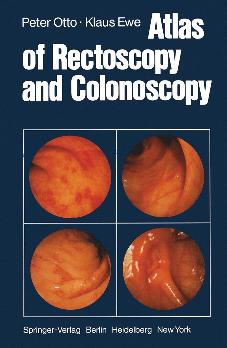 P. Otto, K. Ewe, P. Otto, Klaus Ewe - Atlas of Rectoscopy and Coloscopy, Häftad