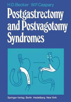 bokomslag Postgastrectomy and Postvagotomy Syndromes