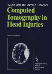 bokomslag Computed Tomography in Head Injuries