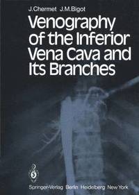 bokomslag Venography of the Inferior Vena Cava and Its Branches