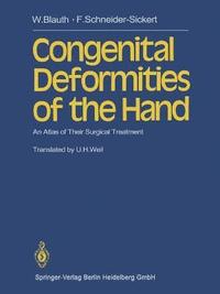 bokomslag Congenital Deformities of the Hand