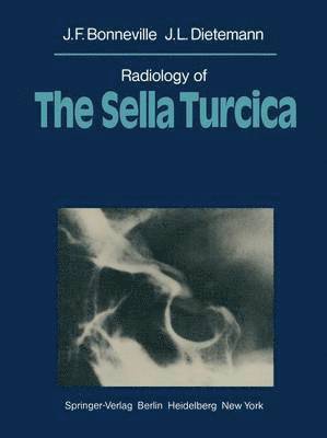 Radiology of The Sella Turcica 1