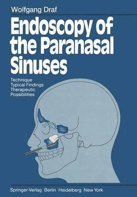 bokomslag Endoscopy of the Paranasal Sinuses