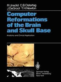 bokomslag Computer Reformations of the Brain and Skull Base