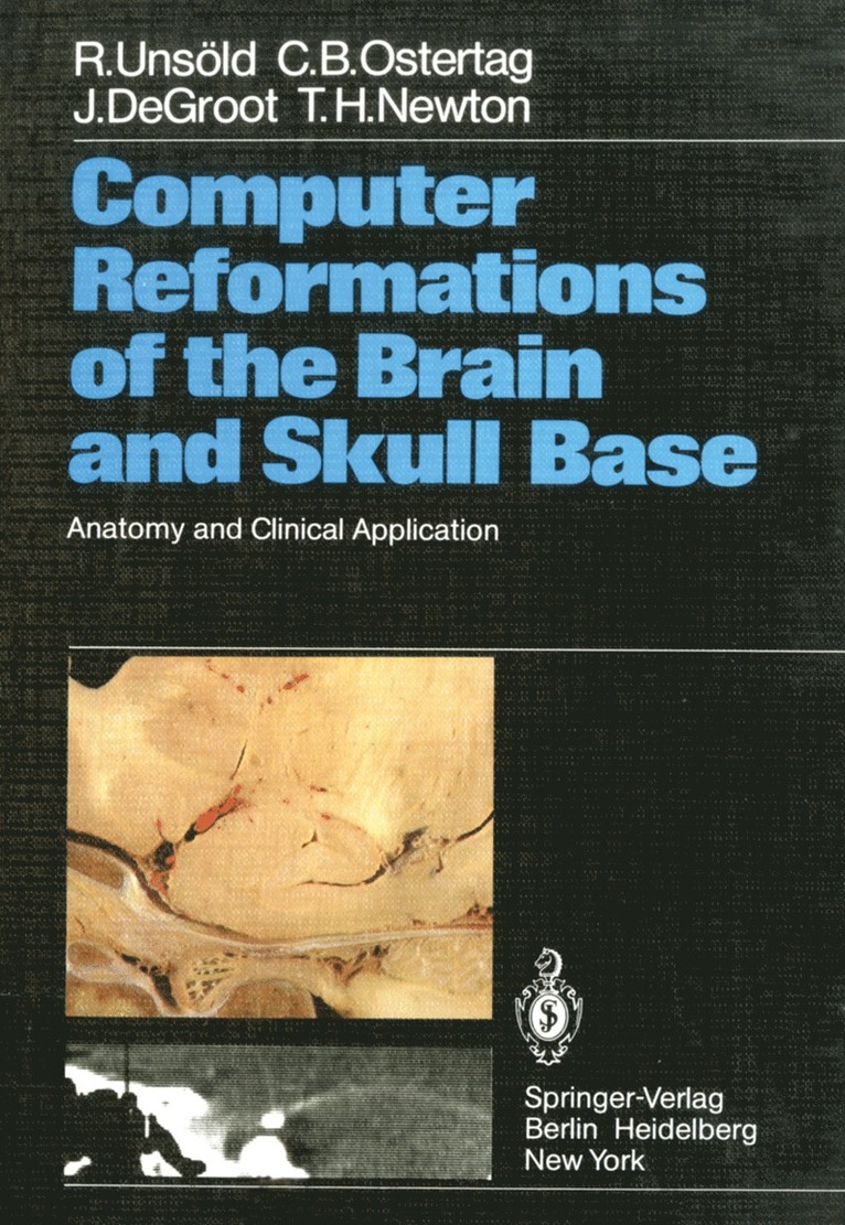 R. Unsöld, C. B. Ostertag, J. DeGroot, T. H. Newton, R. Unsold, R. Unsöld, C. B. Ostertag - Computer Reformations of the Brain and Skull Base, Häftad