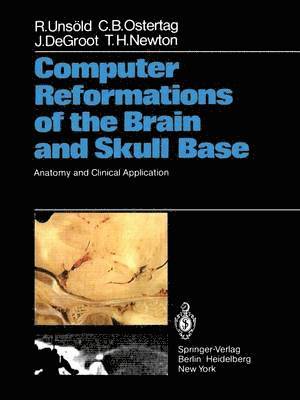 Computer Reformations of the Brain and Skull Base 1