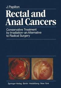 bokomslag Rectal and Anal Cancers