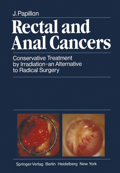 bokomslag Rectal and Anal Cancers