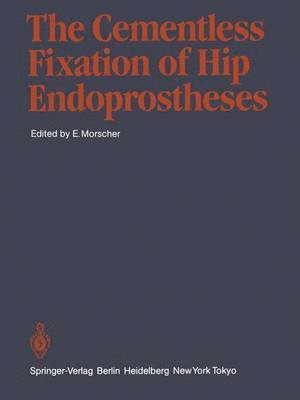 bokomslag The Cementless Fixation of Hip Endoprostheses