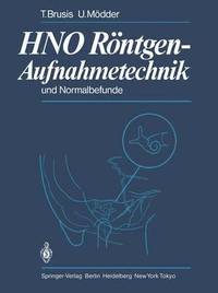 bokomslag HNO Rntgen-Aufnahmetechnik und Normalbefunde
