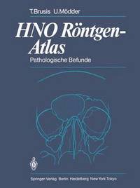 bokomslag HNO Rntgen-Atlas