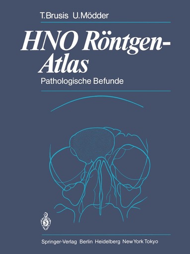 Tilman Brusis, Ulrich Mödder - HNO Röntgen-Atlas, Häftad