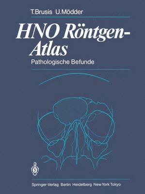 HNO Rntgen-Atlas 1